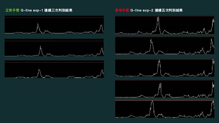 正常手臂與異常手臂比較